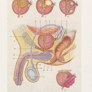 Small French Vintage prostate medical print 1962. Antique anatomy print. Doctor office Wall art Medical gift for medical urology decor