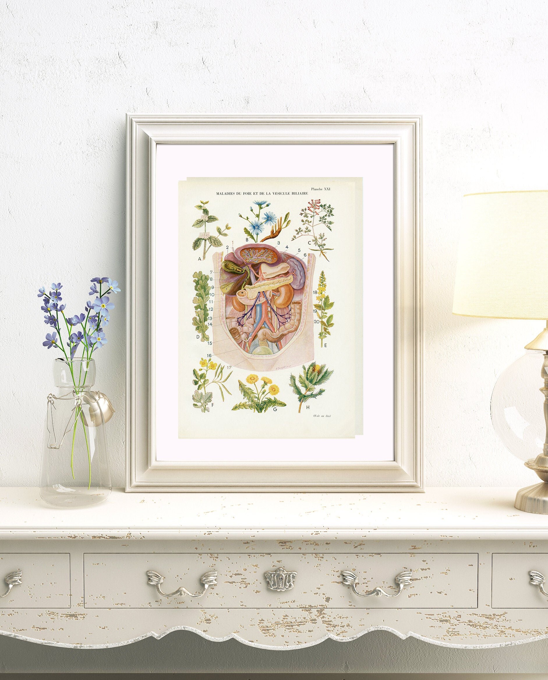 Gravure d'anatomie Vintage de 1950 Maladies Du Foie & Vésicule. Illustration Médicale Anatomique. Dé