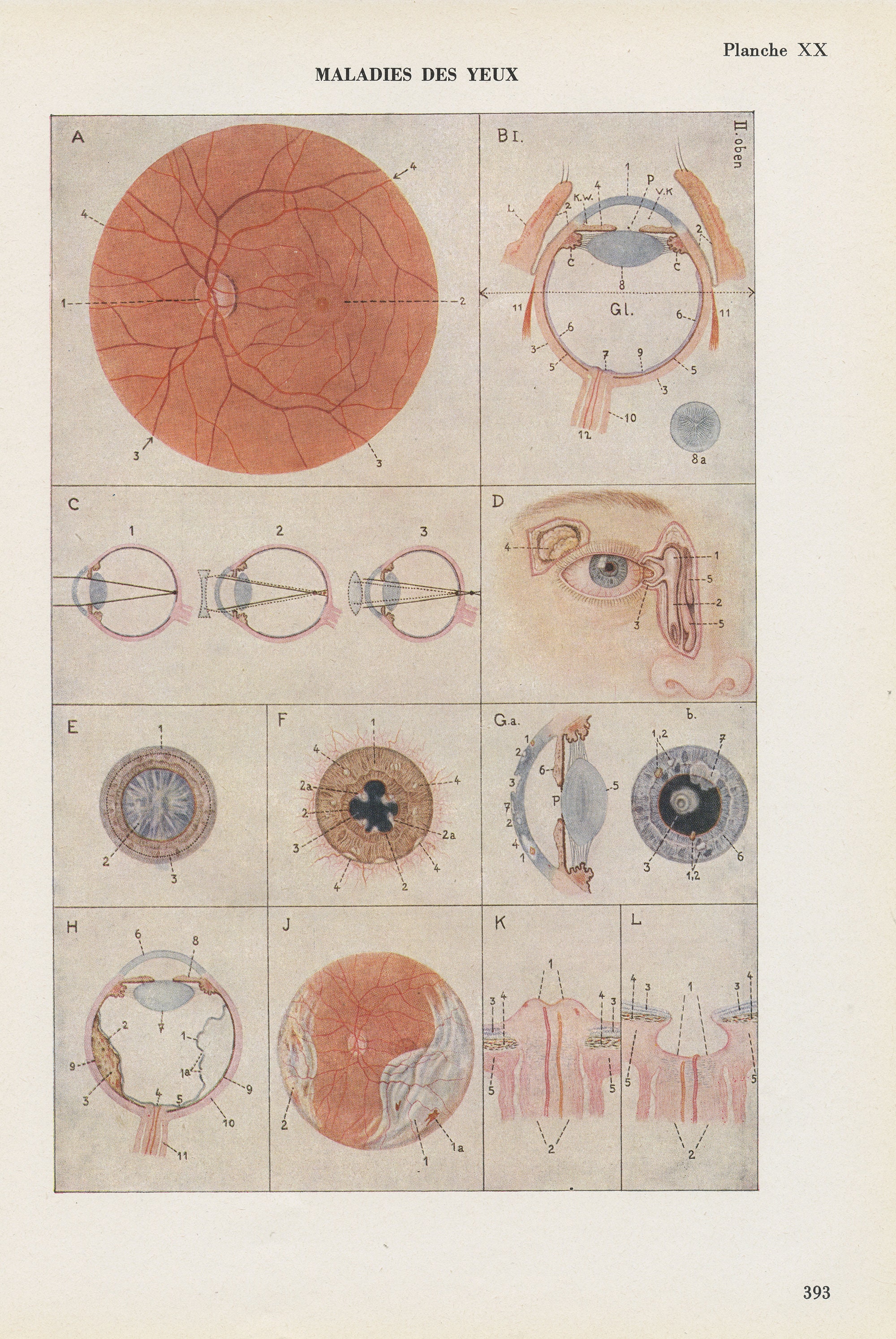 Gravure Médicale de Maladies Des Yeux Vintage 1962. Illustration Médicale. Décoration Cabinet Cadeau