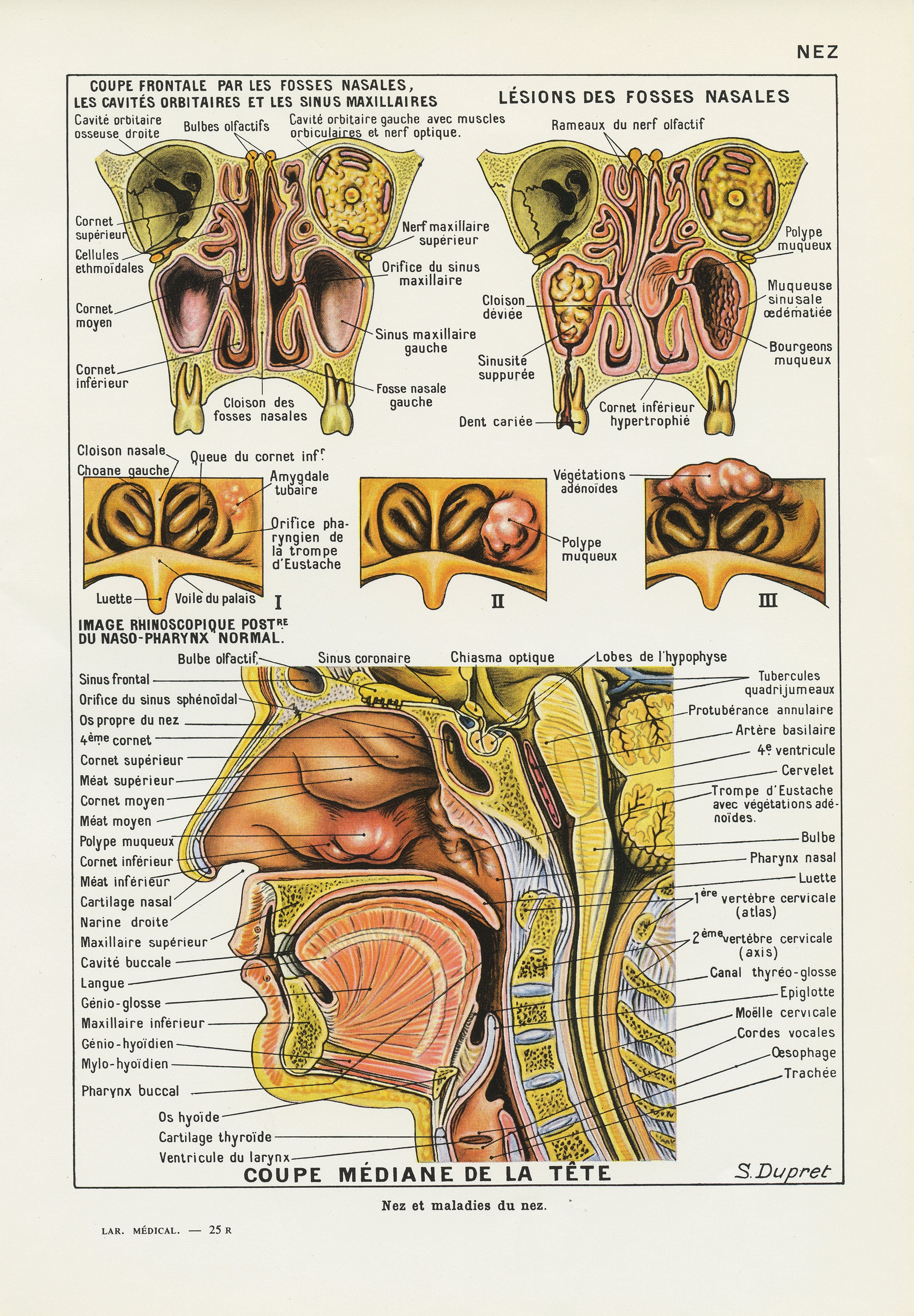 Nez 1952 Gravure d'anatomie Vintage Coupe Du Nez Déco Médicale Cadeau Pour Médecin Poster de Cabinet
