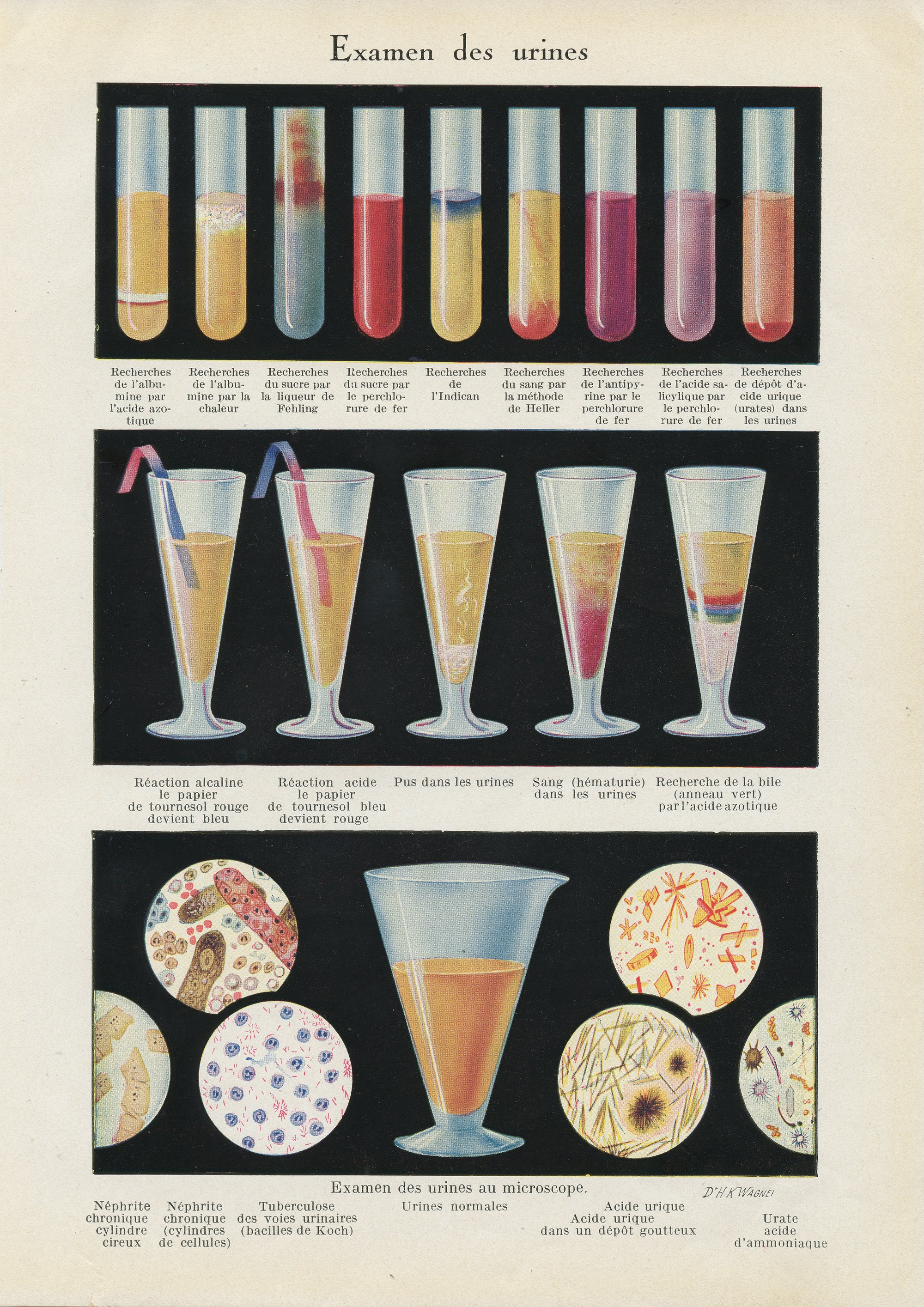 Gravure Médicale d'analyse d'urine Vintage de 1962. Illustration Médicale. Décoration Cabinet Cadeau