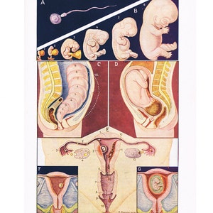 Instant download foetus poster 1957 Digital pregnancy poster Digital pregnancy print Gynaecologist gift Obstetrics poster Obstetrician gift