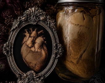 Op de afbeelding: Een anatomisch hartmodel in een sierlijke, ovale, goudkleurige metalen lijst met gedetailleerde bladmotieven, naast een doorzichtige glazen pot met een anatomisch hart geconserveerd in vloeistof en een zilverkleurig metalen deksel.