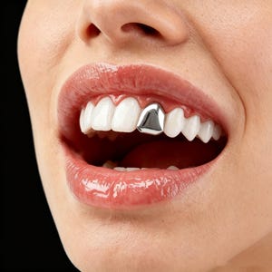 Może przedstawiać: Pojedyncza srebrna nakładka na ząb umieszczona na górnym siekaczu. Ten metalowy dodatek dentystyczny ma gładką, odblaskową powierzchnię i znajduje się pomiędzy naturalnymi białymi zębami w otwartych ustach, tworząc wyraźny kontrast.