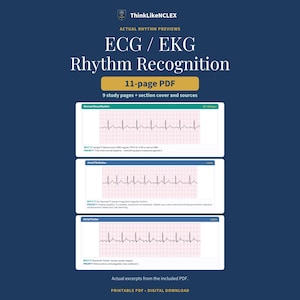 May include: An 11-page PDF titled ThinkLikeNCLEX ECG / EKG Rhythm Recognition. The document features study pages with grid-background rhythm strips for Normal Sinus Rhythm, Atrial Fibrillation, and Atrial Flutter, including clinical notes and text.