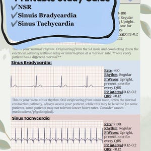 Może przedstawiać: Przewodnik do nauki do druku zatytułowany ECG Rhythms z sekcjami dotyczącymi NSR, bradykardii zatokowej i tachykardii zatokowej. Dokument zawiera czarno-białe zapisy elektrokardiogramu, definicje kliniczne oraz tabele danych dotyczące tętna, rytmu, załamków P, odstępu PR i czasu trwania zespołu QRS.