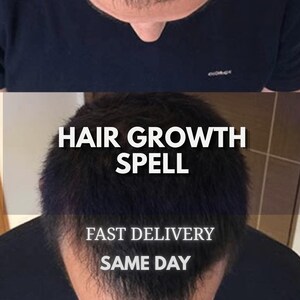 May include: A top-down view of a person with short, dark hair wearing a black t-shirt. The image features the white text "HAIR GROWTH SPELL" prominently displayed in the centre, with the additional white text "FAST DELIVERY SAME DAY" below it.