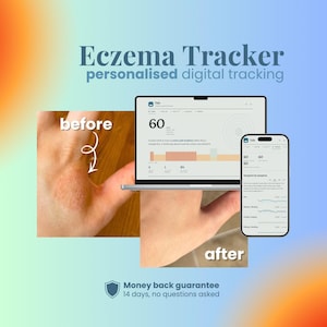 May include: A digital eczema tracker interface displayed on a laptop and smartphone screen. The image shows a before and after comparison of skin condition, with text labels reading Eczema Tracker, personalised digital tracking, and Money back guarantee.