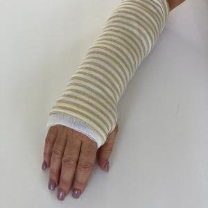 Arm Cast Cover Black/Silver or Gold/White Options image 1