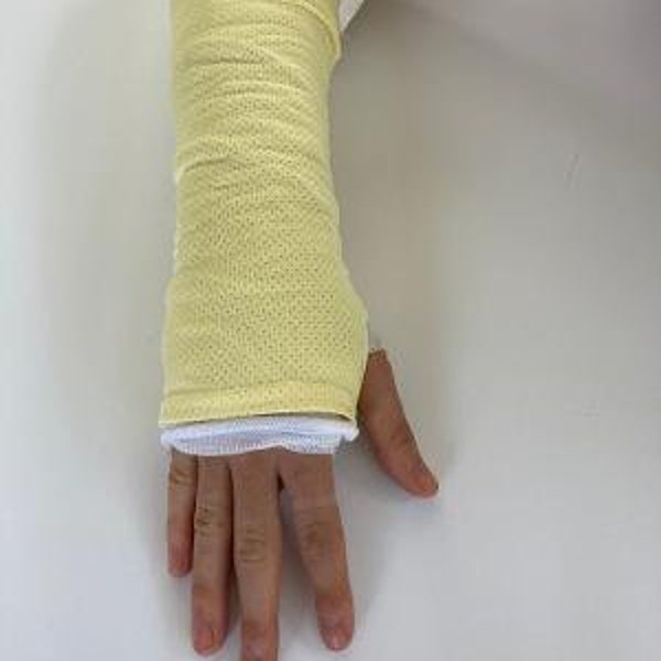 Arm Cast Cover - Stripe and Solids