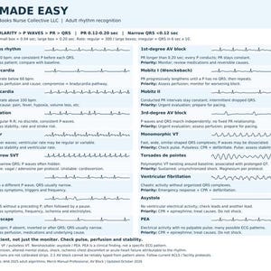 May include: A white educational reference chart titled EKG MADE EASY by Beyond the Books Nurse Collective LLC. It features black text and EKG rhythm strips for adult rhythm recognition, including sinus rhythms, blocks, and various arrhythmias.