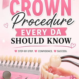 Op de afbeelding: Een tandheelkundige weergave met de tekst CROWN Procedure EVERY DA SHOULD KNOW, STEP-BY-STEP. CONFIDENCE. SUCCESS. Een kleurengids, metalen tandheelkundige instrumenten, een gebitsmodel en een notitie met A great crown starts with great details! in roze.