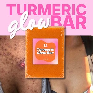 Turmeric Glow Bar Soap | Goat Milk Face Cleanser for Hyperpigmentation, Acne