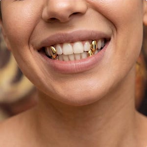 May include: A set of gold tooth caps worn on the upper and lower canine teeth. The metallic gold covers are smooth and reflective, fitted individually over the natural teeth to create a distinct appearance within the mouth while smiling.