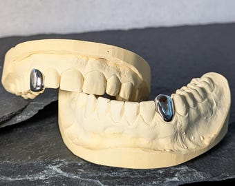 Einzelzahn Grillz Silber & Gold | Zahnschmuck Maßanfertigung | Individuelle Grillz Einzelzahn mit Abdruckset