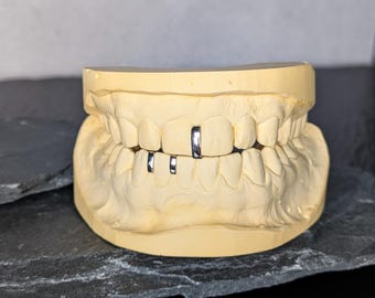 Minimalistische Lückenfüller Grillz | Individueller Zahnschmuck Silber | Lückenfüller Grillz mit Abformset | Einzelzahn Cap