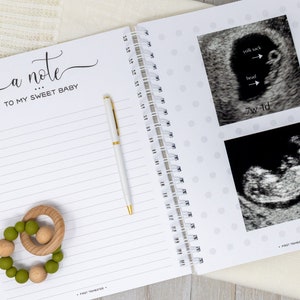 May include: A white journal with a grey polka dot pattern and a spiral binding. The journal has a section for writing a note to a baby and a section for ultrasound photos. The ultrasound photos show a baby at 7 weeks and 1 day and 9 weeks. The text "a note... to my sweet baby" is written on the journal.