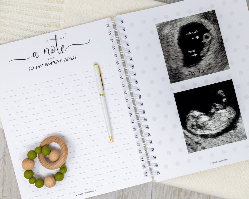 May include: A white journal with a grey polka dot pattern and a spiral binding. The journal has a section for writing a note to a baby and a section for ultrasound photos. The ultrasound photos show a baby at 7 weeks and 1 day and 9 weeks. The text "a note... to my sweet baby" is written on the journal.