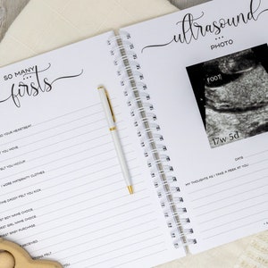 May include: A black and white journal with the text "So Many Firsts" on the cover. The journal has a spiral binding and is open to a page with the title "Ultrasound Photo". The page has a black and white ultrasound image with the text "17w 5d" and "Foot".