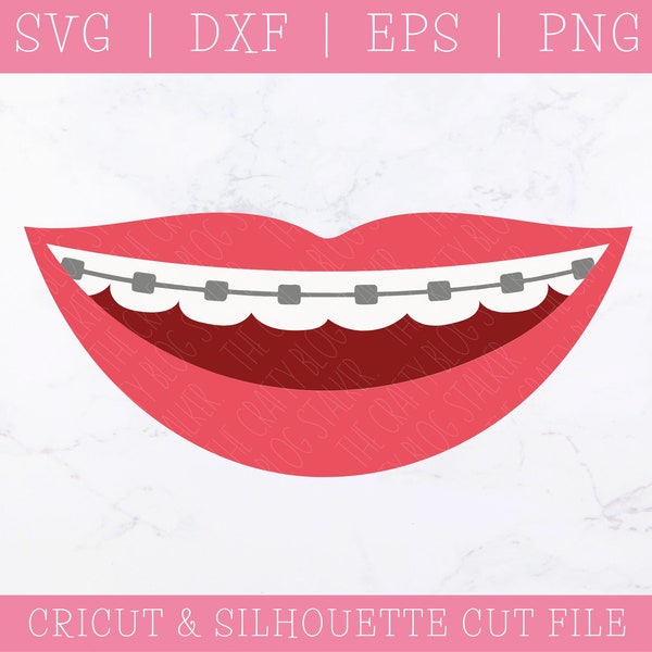 Braces SVG DXF PNG - Face Mask svg - Mouth svg - Smiling Teeth svg Digital - Smile svg - Lips svg - Dentist svg Cut File - Cricut svg