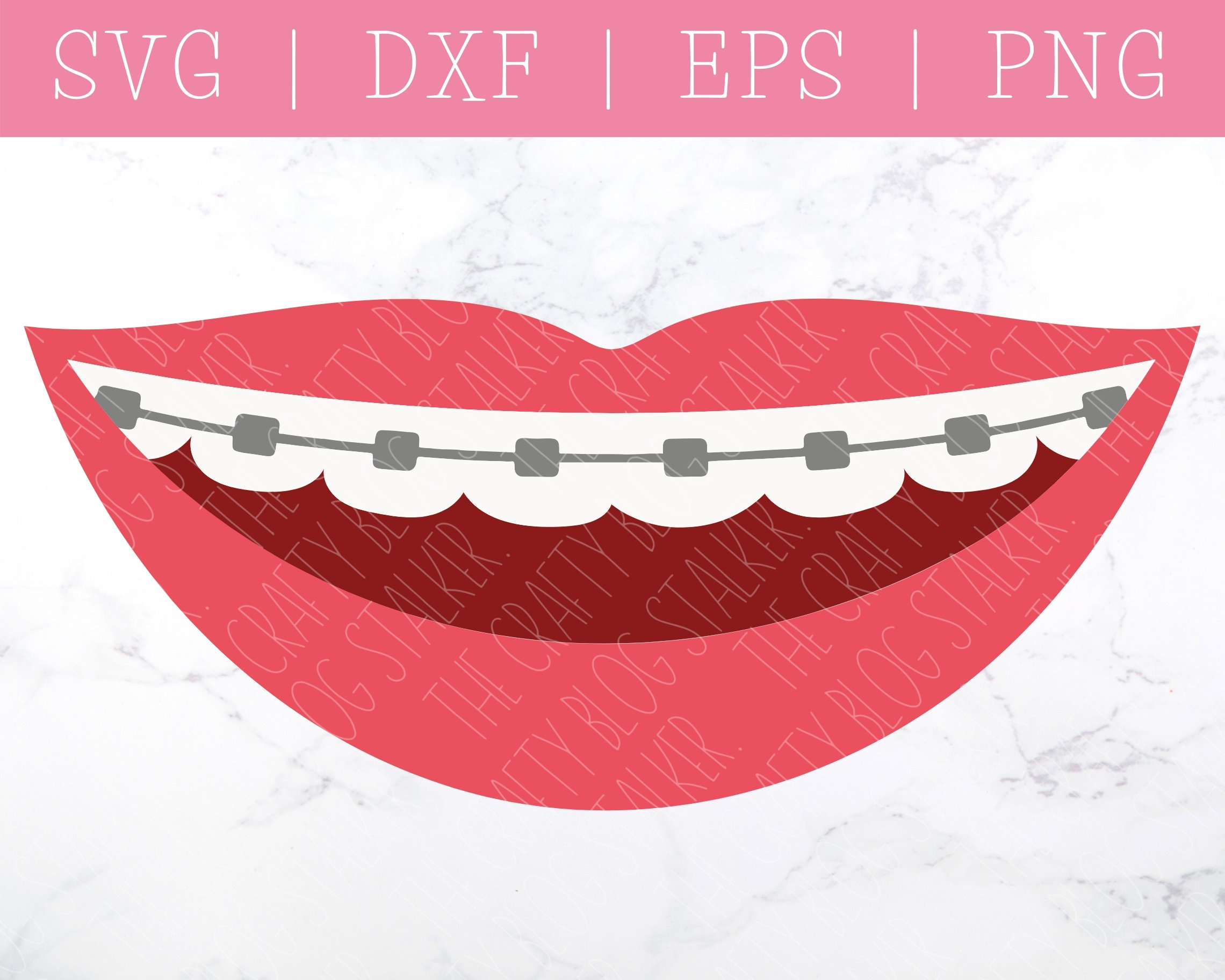Free Free Smile With Braces Svg 302 SVG PNG EPS DXF File