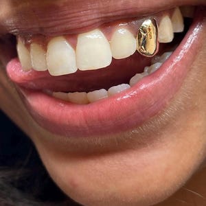 May include: A single gold tooth cap fitted over an upper lateral incisor. The dental accessory features a polished, reflective metallic surface that covers the natural tooth enamel, creating a distinct contrast against the surrounding teeth.