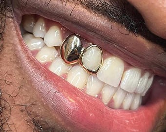 Op maat gemaakte, vlakke en open raamgrills in goud of zilver.
