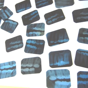 May include: A collection of 17 black and white dental x-rays, each showing a different view of the teeth.