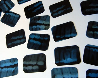 Lot of 30+ Xrays Tooth Film Dental X-Rays - Tooth Xrays - Bone -  mix of two different sizes -- 1 5/8" x 1 1/4 and 1 1/2" x 1"