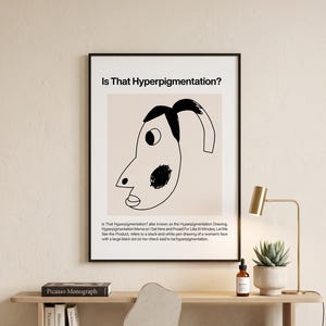 May include: A framed wall art print featuring a black line drawing of a face with a large black dot on the cheek, set against a beige background. The text at the top reads Is That Hyperpigmentation? with descriptive text at the bottom.