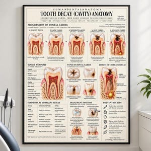 May include: A framed educational poster titled Human Dental Anatomy Tooth Decay Cavity Anatomy. The chart features detailed cross-section illustrations of teeth showing the progression of dental caries, types of decay, symptoms, and prevention tips.