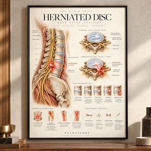 Puede incluir: Un póster educativo médico titulado The Human Spine Herniated Disc Lumbar Spine Anatomy. Presenta ilustraciones anatómicas detalladas de la columna vertebral, vistas axiales de discos, morfología, síntomas y opciones de tratamiento médico.