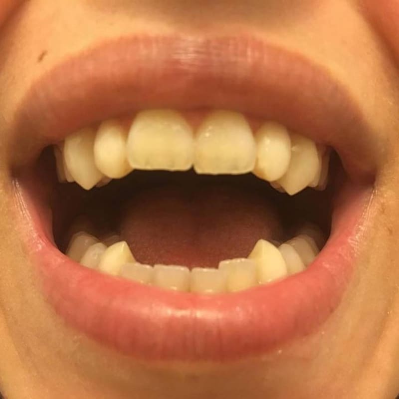 Werewolf Fangs - Etsy