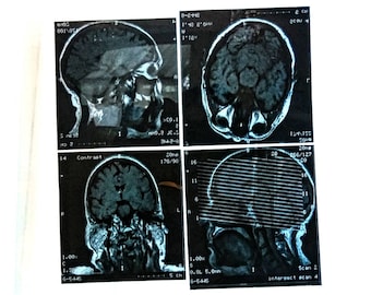 4-delige mini vintage hoofdröntgenfoto's, vintage hersenscans MRI, lichaamsscans MRI, medische beelden, donkere academische verschijnselen, halloweendecor, 3,5"