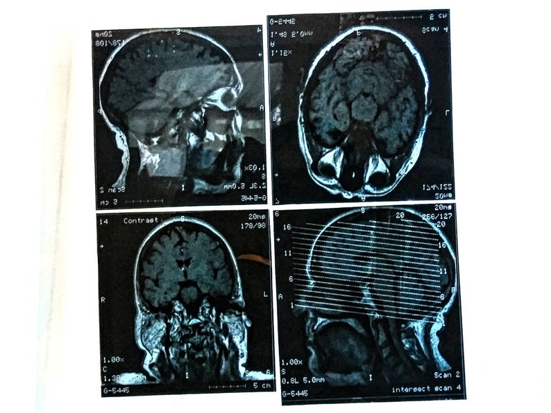 4 pc Mini Vintage Head X-rays, Vintage Brain Scans MRI, Transparent Medical Images, Dark Academia Ephemera, Unusual Halloween Decor, 3.5 image 1