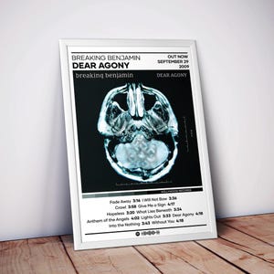 May include: A framed poster featuring the Breaking Benjamin album Dear Agony. The design includes a black and white MRI scan of a human brain, the album tracklist with song durations, the release date September 29, 2009, and a Spotify code.