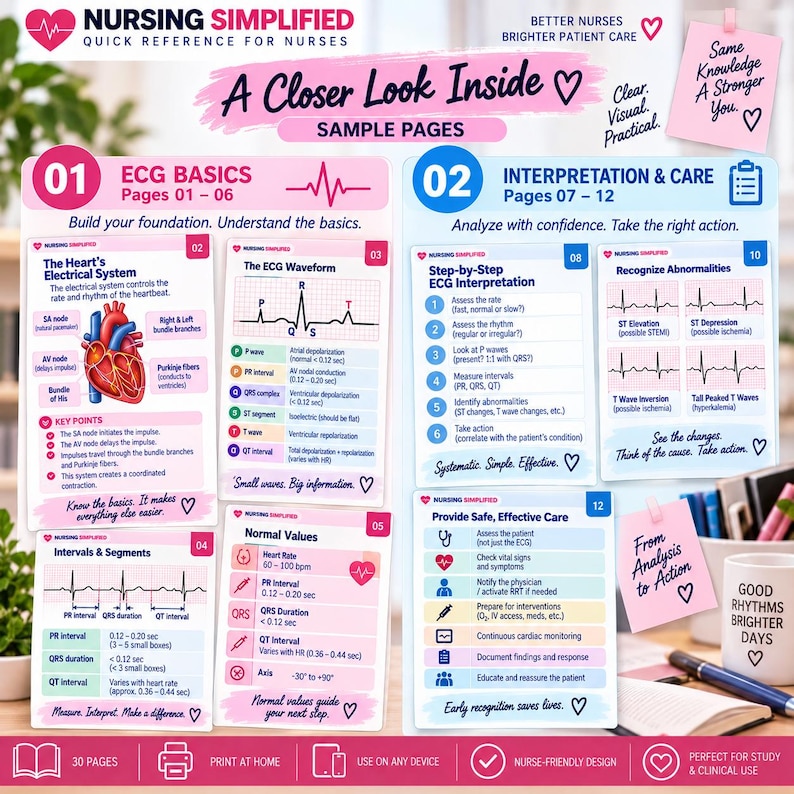 ECG Simplified Quick Reference for Nurses | 30-page Digital PDF Guide ...