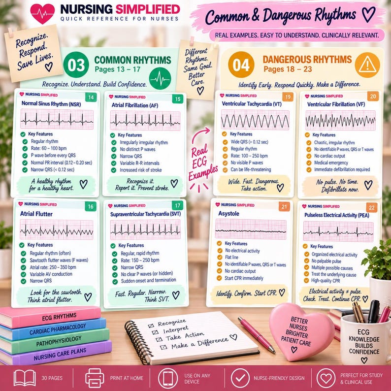 ECG Simplified Quick Reference for Nurses | 30-page Digital PDF Guide ...