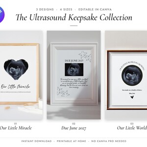 Może przedstawiać: Trzy oprawione wydruki pamiątkowe z USG zatytułowane The Ultrasound Keepsake Collection. Projekty obejmują USG w kształcie serca z napisem Our Little Miracle, wydruk Due June 2027 z gwiazdkami oraz okrągłe USG z napisem Our Little World Is Growing.