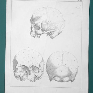 May include: Anatomy illustration of a human skull, depicted in three different views: side profile, frontal, and top-down. The detailed drawing is in black and white, with numbered labels throughout.