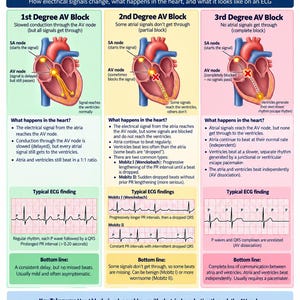 May include: An educational infographic titled Student into Nurse Heart Block Guide. It features three columns detailing 1st, 2nd, and 3rd degree AV blocks with anatomical heart diagrams, ECG rhythm strips, and text explanations of electrical conduction.