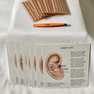 May include: A set of adhesive ear acupressure patches on clear plastic sheets, an orange pair of tweezers, and a stack of instructional cards. The top card features a diagram of an ear with labeled points for weight loss and descriptive text.