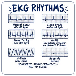 May include: A white educational chart titled EKG RHYTHMS in dark blue text. It displays six grid-lined boxes showing heart rhythm tracings labeled Normal Sinus, Sinus Brady, Sinus Tachy, A-Fib, V-Tach, and Asystole with descriptive text below each.