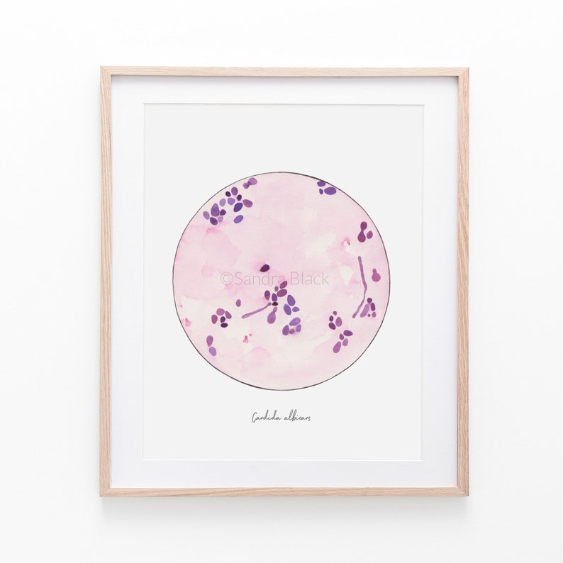 Candida albicans, microbiology, mycology, microbiology art, science, science art, biology, medical art, fungi, yeast art, art print, print image 2