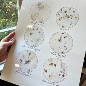 Cristales de orina, ciencia, arte científico, biología, química, técnico de laboratorio, enfermera, regalo de enfermera, medicina, arte médico, impresión artística, impresión científica