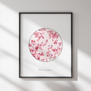 Plasmodium falciparum, malaria, medical art, biology art, medical print, science art, science print, biology print, infectious disease
