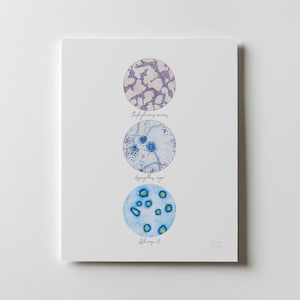 StaphAsperFlu, Micro Collection 3, Print, Art Print, Microbiology, Microbes, Bacteria Art, Bacteria, Science Art, Bacteria Print, Bacterium