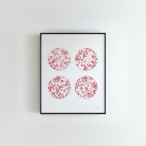 Blood Smear Collection, Science art, biology art, science gift, red blood cells, watercolor sciart, malaria, sickle cell anemia, blood