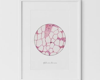 Aplastic Anemia, Bone Marrow, Histology, Histology Art, Science Art, sciart, biology art, medical print, science print, biology print