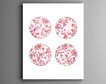 Blood Smear Collection, Science art, biology art, science gift, red blood cells, watercolor sciart, malaria, sickle cell anemia, blood